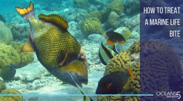 Are Backswimmer bites dangerous?