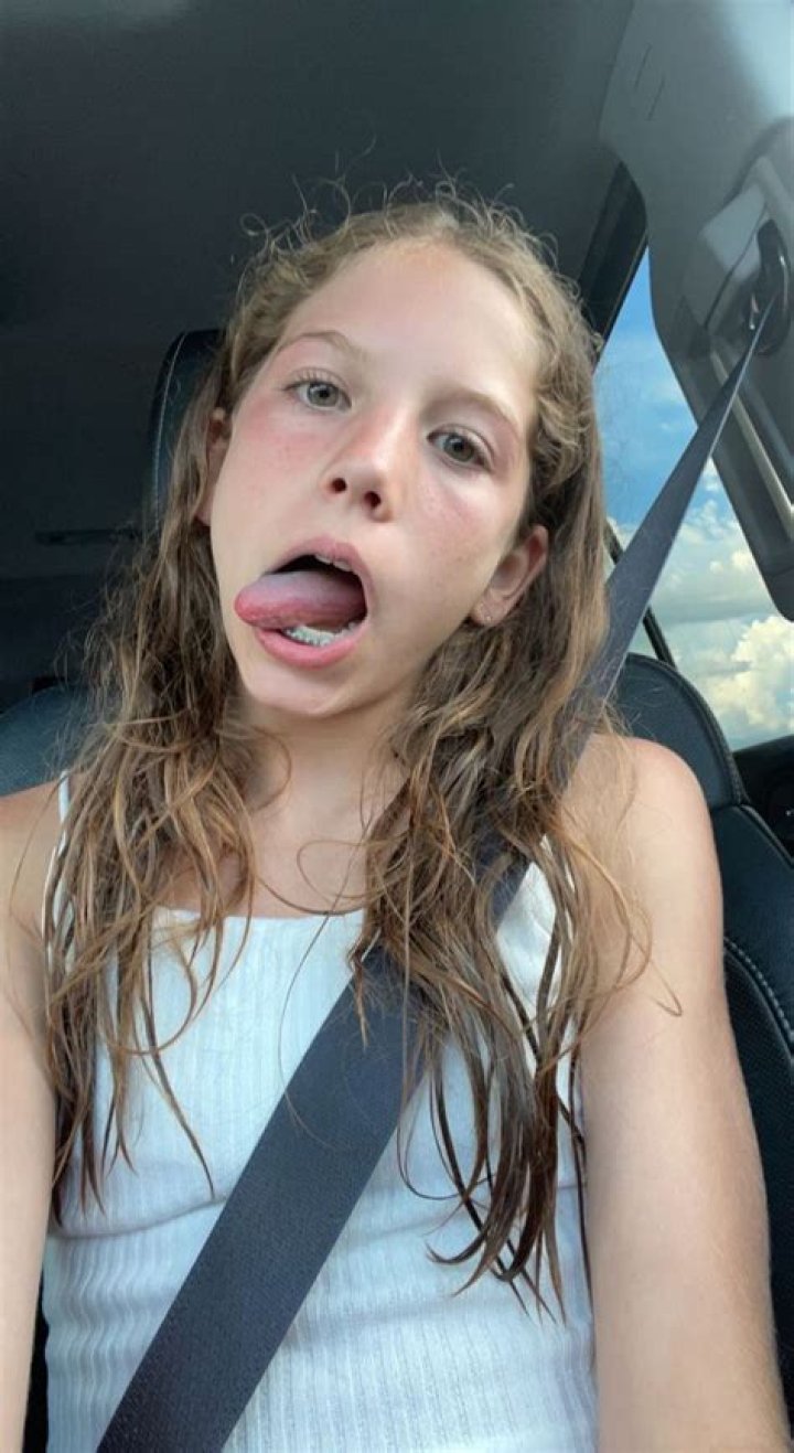 Braceface Nunu Net Worth, Age, Girlfriend, Family, Biography & More