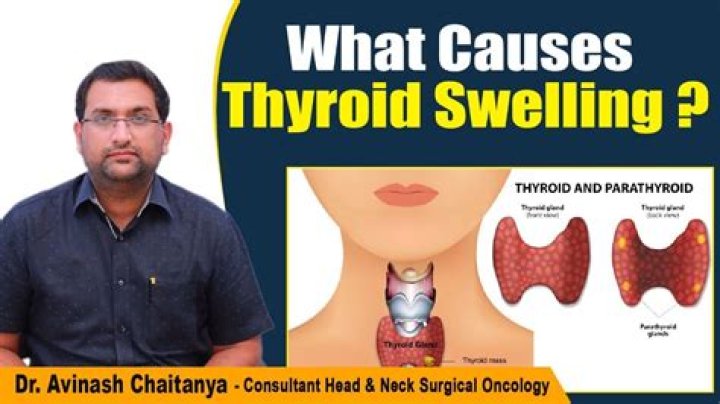 Can a parathyroid tumor cause difficulty swallowing?
