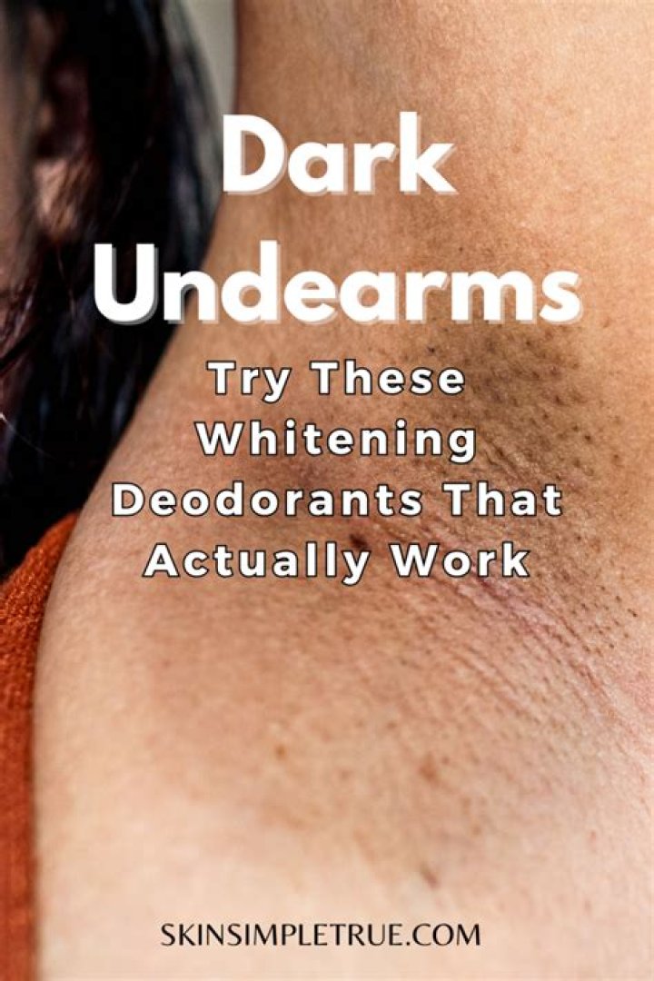 Can deodorant cause dark armpits?