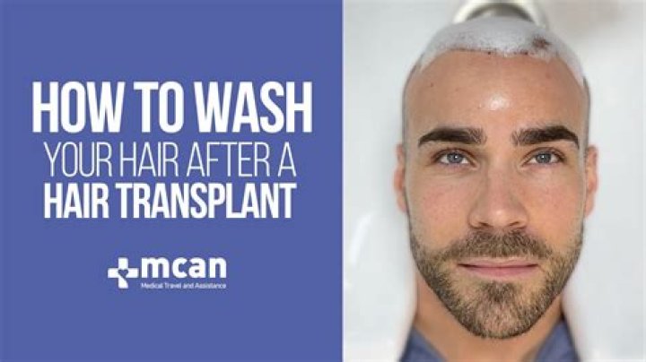 Can I wash my hair before surgery?
