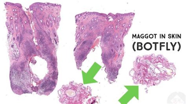 Can maggots form from nothing?