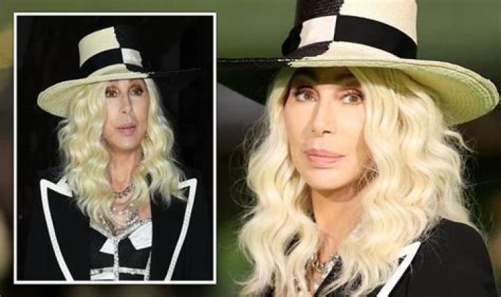 Cher Illness: What Disease Does Cher Have?