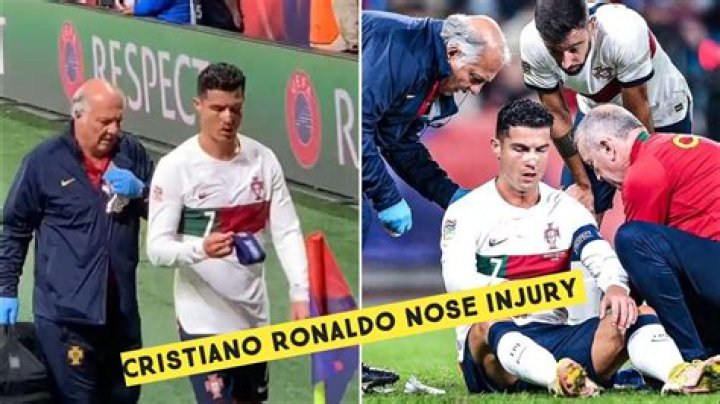 Cristiano Ronaldo nose injury video