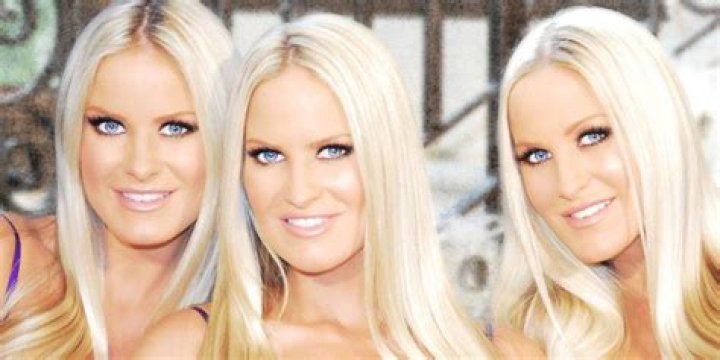 Dahm Triplets Wiki Bio, Parents, Plastic Surgery, Children, Net Worth