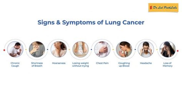 Did Cynthia Lennon have lung cancer?