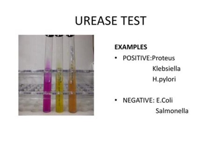 Does E coli test positive for urease?