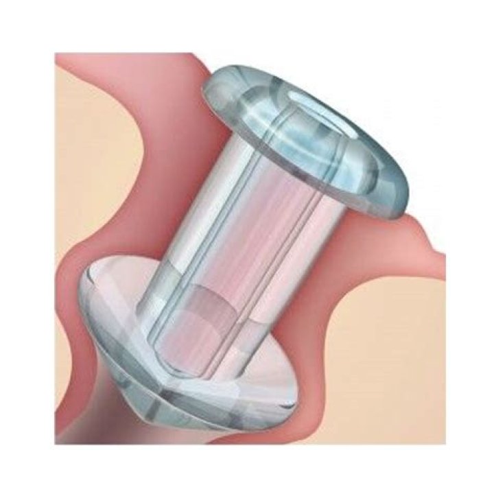 Does insurance cover punctal plugs?