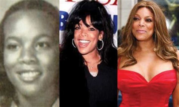 Has Wendy Williams Done Plastic Surgery? Fans Curious About Her Nose Job And Botox