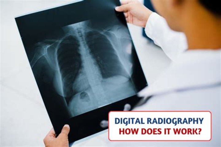 How do radiography and fluoroscopy compare?