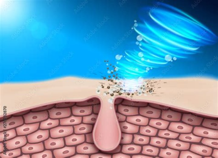 How do you get ingrained dirt off your skin?