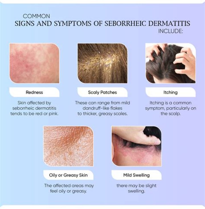 How do you pronounce seborrheic dermatitis?