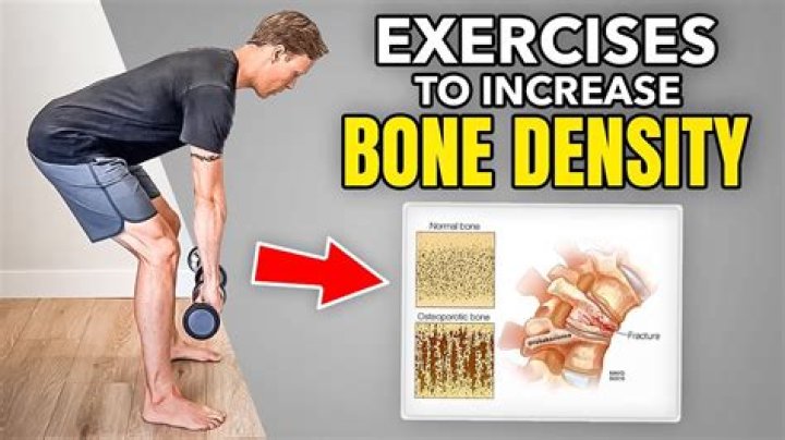 How much do bone density Techs Make?
