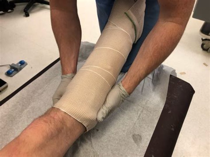 How much does a short leg fiberglass cast weigh?