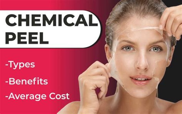 How much is a Massage Envy chemical peel?