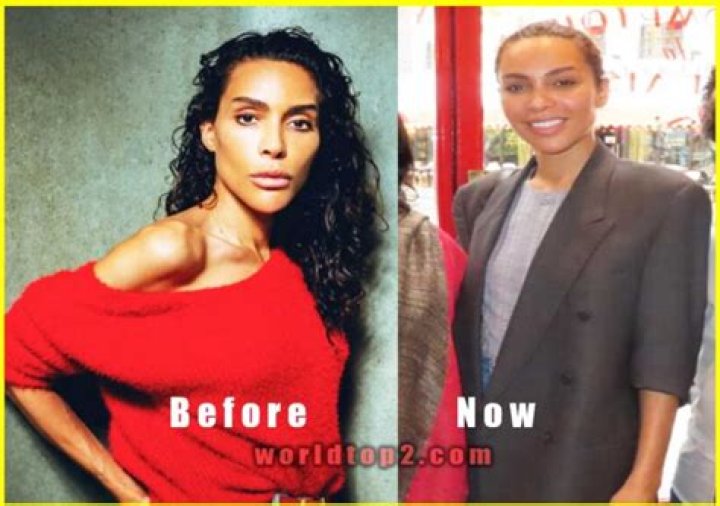 Ines Rau Plastic Surgery: Before And After Looks