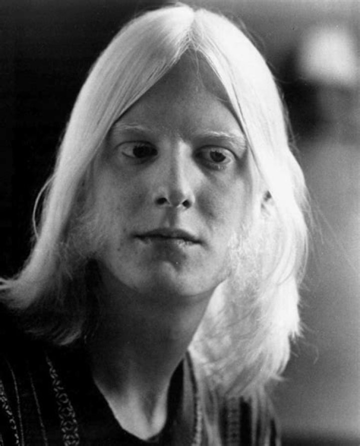 Is Edgar Winter Albino?