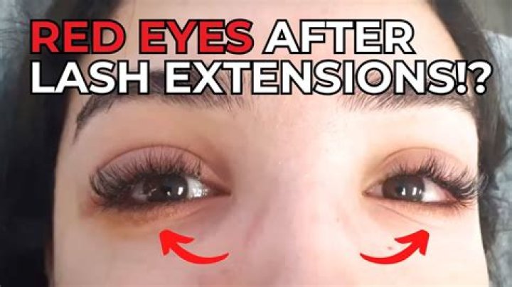 Is it normal for your eyes to be red after eyelash extensions?