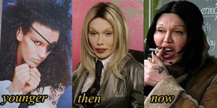 Is Pete Burns Transgender? Gender And Sexuality- Transformation And Surgery