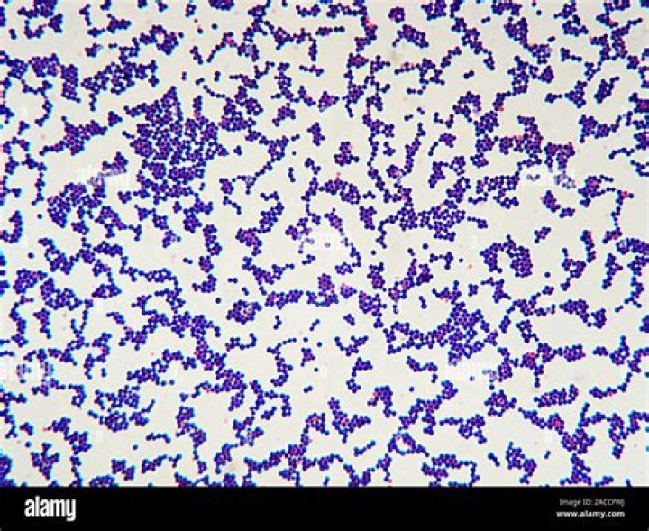 Is Staphylococcus aureus catalase positive or negative?