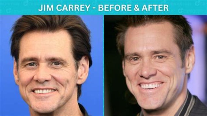 Jim Carrey Illness: What disease does Jim Carrey have?