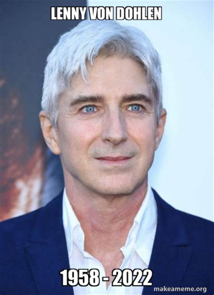 Lenny von Dohlen eyes: What’s wrong Lenny von Dohlen eyes?