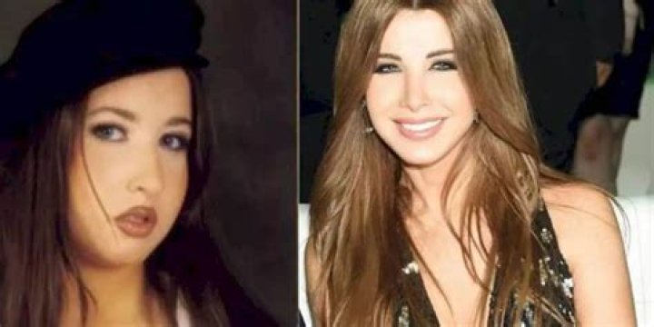 Nancy Ajram Before And After: Has The Lebanese Singer Undergone Plastic Surgery?