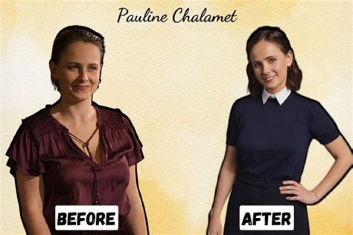 Pauline Chalamet Breast Reduction: Timothee Chalamet Sister Weight Loss Before And After
