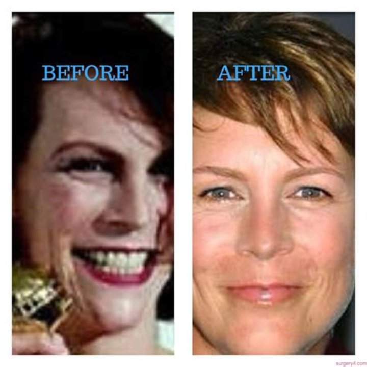 Tracey Bregman Plastic Surgery With Impressive Before and After Photos