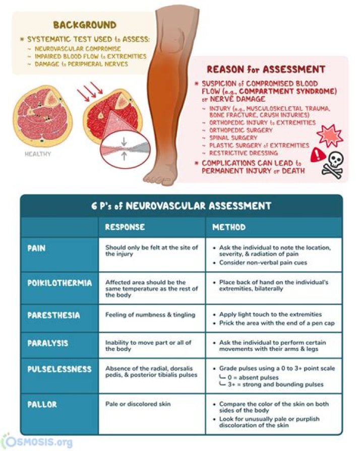 What are the 6 P’s of musculoskeletal trauma?
