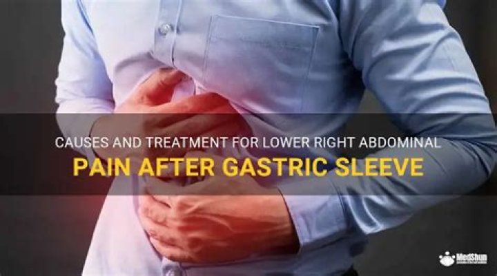 What can you take for pain after gastric sleeve?