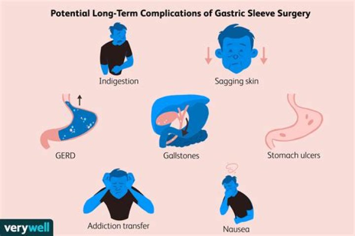 What causes headaches after gastric sleeve surgery?