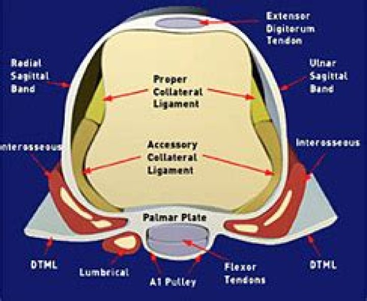 What causes sagittal band rupture?