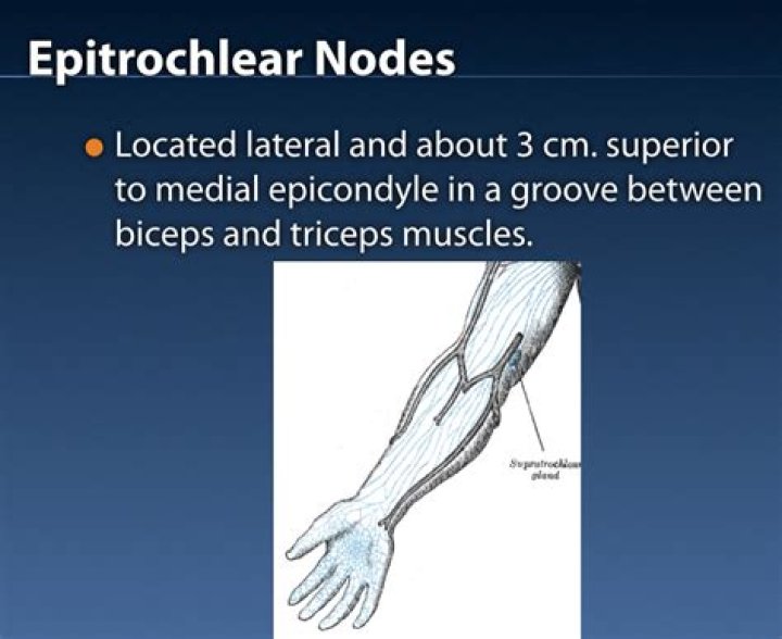 What causes swollen Epitrochlear lymph nodes?