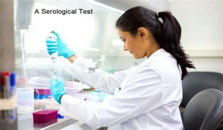 What does a serologist do?