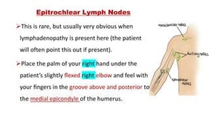 What does an enlarged Epitrochlear lymph node mean?