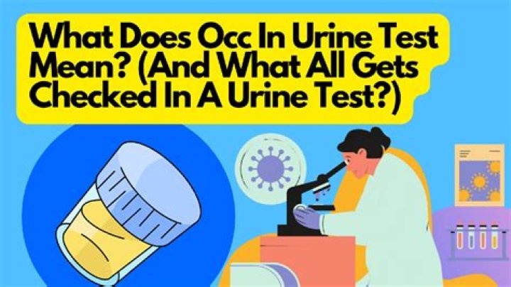 What does OCC in urine test mean?