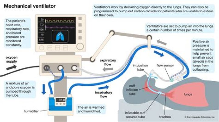 What does Pip mean on a ventilator?