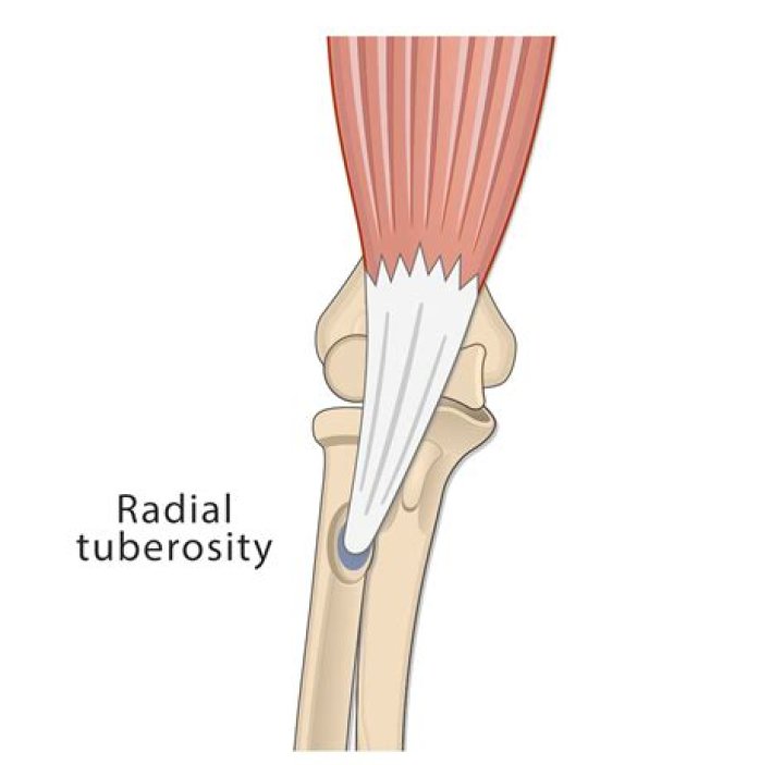 What does the radial tuberosity do?