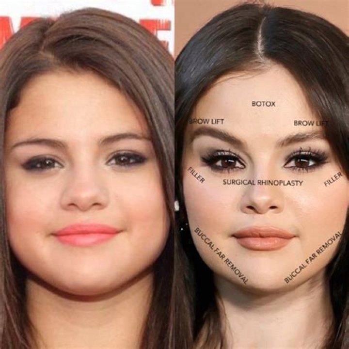 What happened to Selena Gomez face?