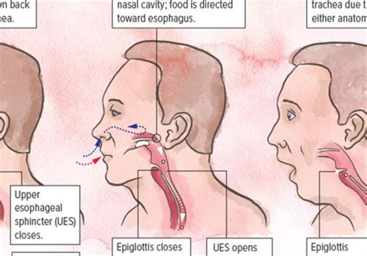 What happens when a lifter collapse?