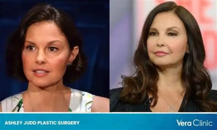 What has happened to Ashley Judd?