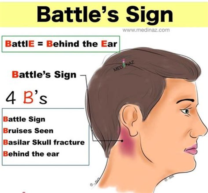 What is a battle sign and what does it indicate?