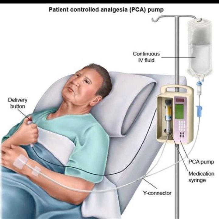 What is patient controlled epidural analgesia?