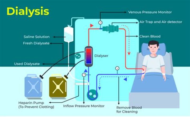 What is Prisma dialysis?