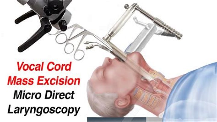 What is suspension Microlaryngoscopy?