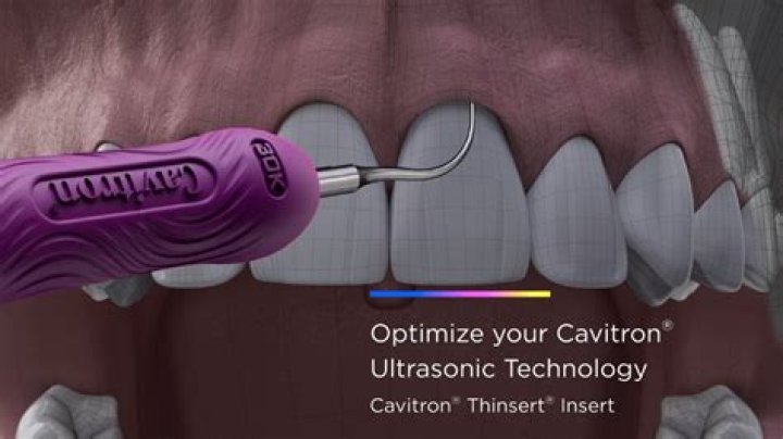 What is the cavitron?