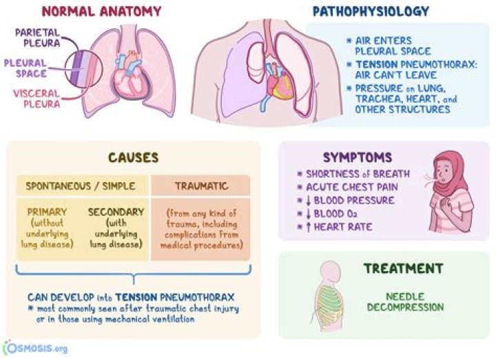 What is the difference between a pneumothorax and a Hemothorax?