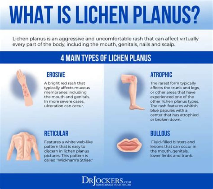 What is the difference between Lichen planus and lichen sclerosus?