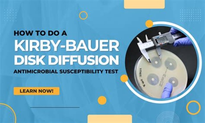 What is the Kirby Bauer disk diffusion method?
